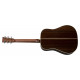 MARTIN HDC-28E (w/LR Baggs)